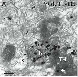 Electron Micrograph
